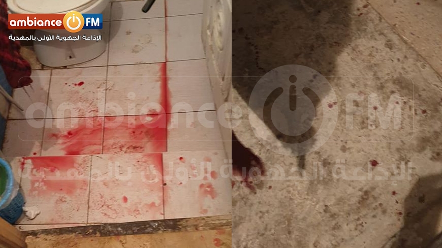 المناقع : في تصرف بربري كهل يعتدي على جاره بآلة حادة